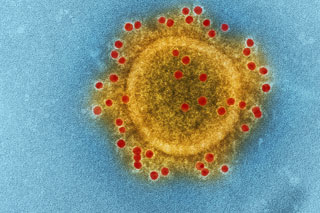gelber Virus mit roten Punkten vor blauem Hintergrund